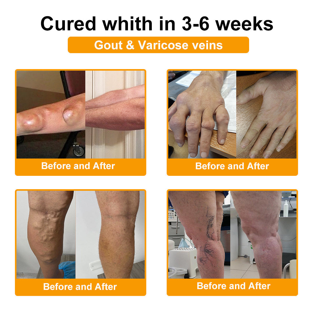 ODALIT™ Botulinum Toxin & Bee Venom Pain-Relief Bone Healing Cream