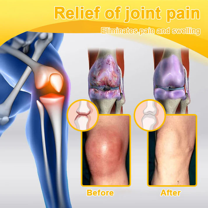 ODALIT™ Botulinum Toxin & Bee Venom Pain-Relief Bone Healing Cream