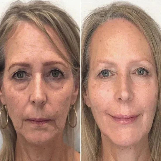 🎁 Last Day Promotion! Seurico™ Clostridium botulinum Face Serum - Smooth & Rejuvenate Your Skin Today ✨💆♀️ (Copy)
