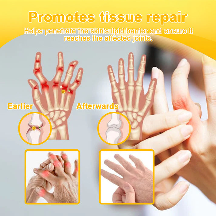 ODALIT™ Pain-Relief & Bone Healing Cream — Clinically Proven with Bee Venom & Botulinum Toxin