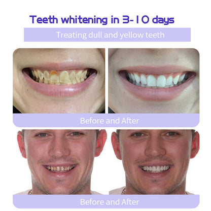 ODALIT™ Teeth Restoration Mineral Powder🦷(ADA recommended) (🎁Flash Sale - Don’t Miss Out)
