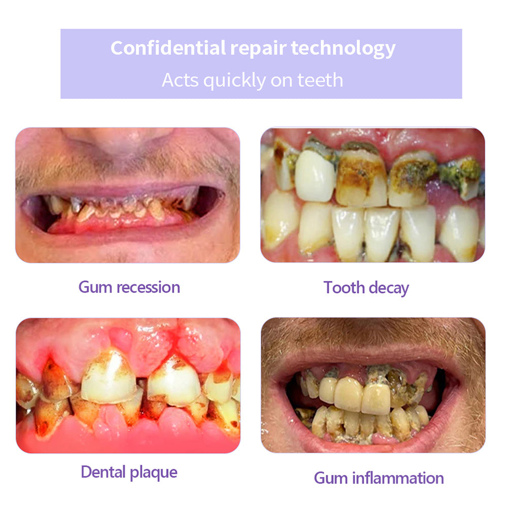 ODALIT™ Teeth Restoration Mineral Powder🦷(ADA recommended) (🎁Flash Sale - Don’t Miss Out)