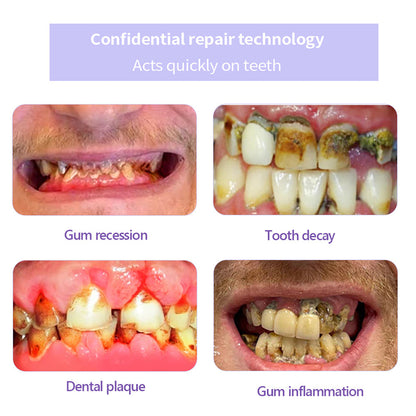 ODALIT™ Teeth Restoration Mineral Powder🦷(ADA recommended) (🎁Flash Sale - Don’t Miss Out)
