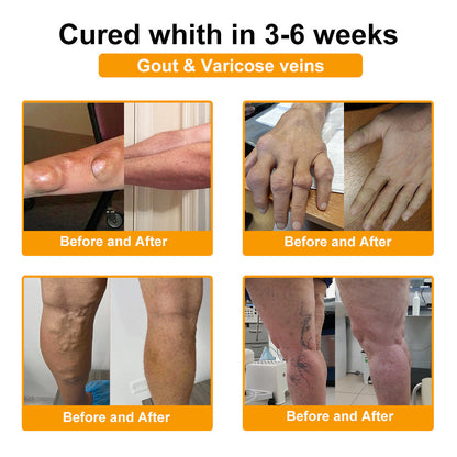 ODALIT™ Pain-Relief & Bone Healing Cream — Clinically Proven with Bee Venom & Botulinum Toxin