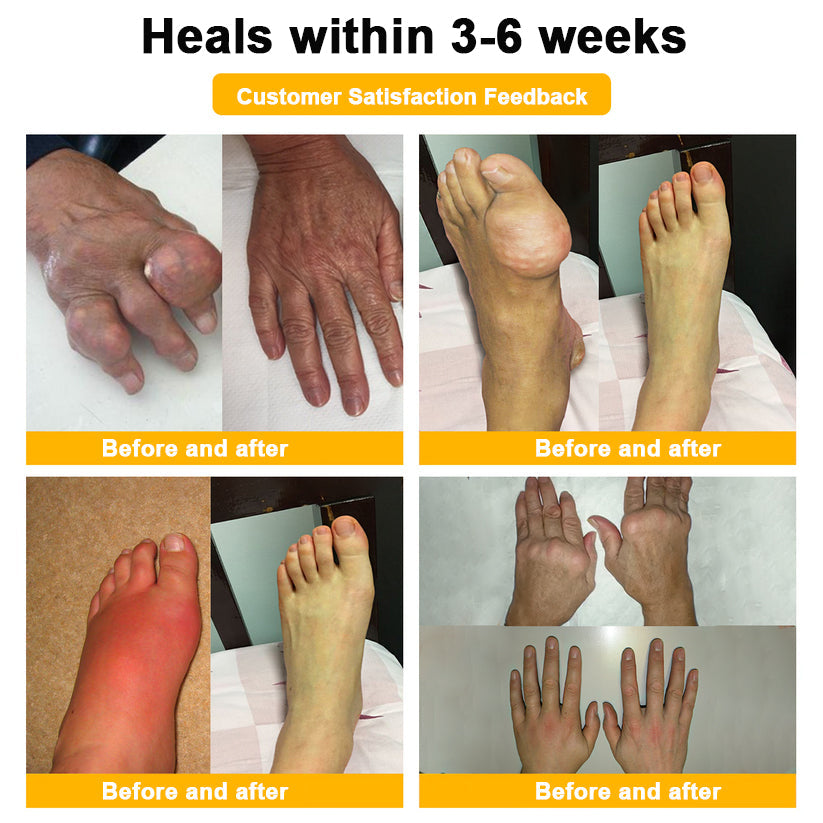 ODALIT™ Pain-Relief & Bone Healing Cream — Clinically Proven with Bee Venom & Botulinum Toxin
