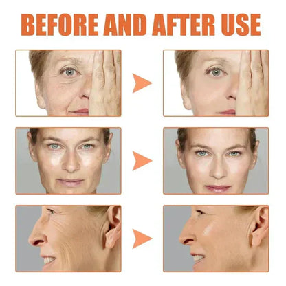 🎁 Last Day Promotion! Seurico™ Clostridium botulinum Face Serum - Smooth & Rejuvenate Your Skin Today ✨💆‍♀️ (Copy)