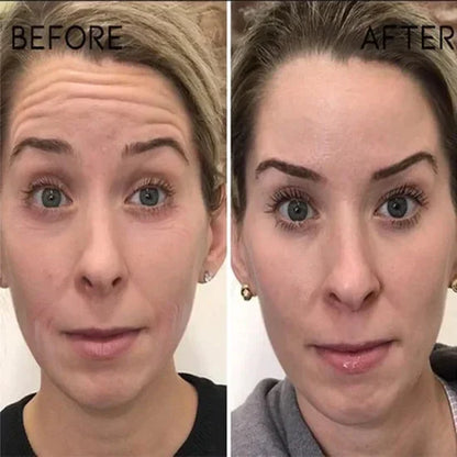 🎁 Last Day Promotion! Seurico™ Clostridium botulinum Face Serum - Smooth & Rejuvenate Your Skin Today ✨💆‍♀️ (Copy)