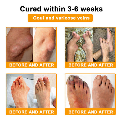 ODALIT™ Pain-Relief & Bone Healing Cream — Clinically Proven with Bee Venom & Botulinum Toxin