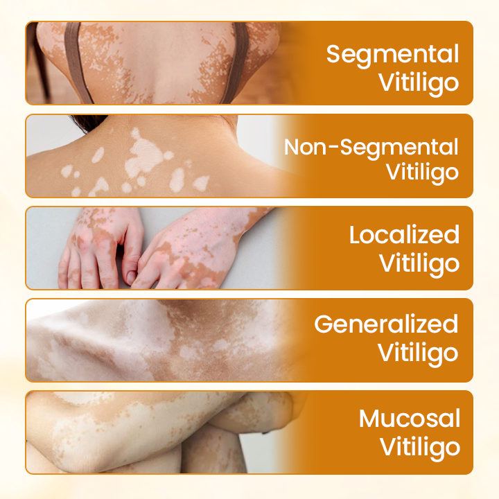 ODEIUN™ VitiClear Pro Bee Venom Cream – Targeted Care for Even-Toned Skin