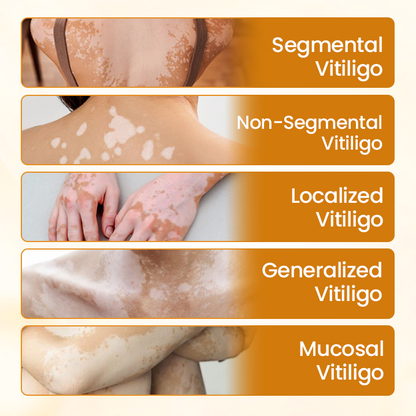 ODEIUN™ VitiClear Pro Bee Venom Cream – Targeted Care for Even-Toned Skin