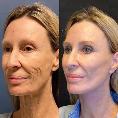 🎁 Last Day Promotion! Seurico™ Clostridium botulinum Face Serum - Smooth & Rejuvenate Your Skin Today ✨💆‍♀️ (Copy)