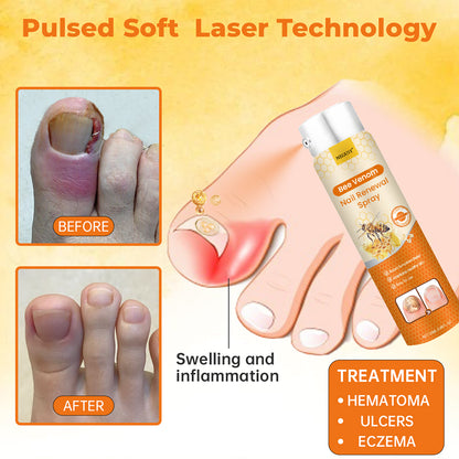 Negusy™ Bee Venom Nail Renewal Spray – Natural Strength & Repair for Healthy Nails 🐝💅