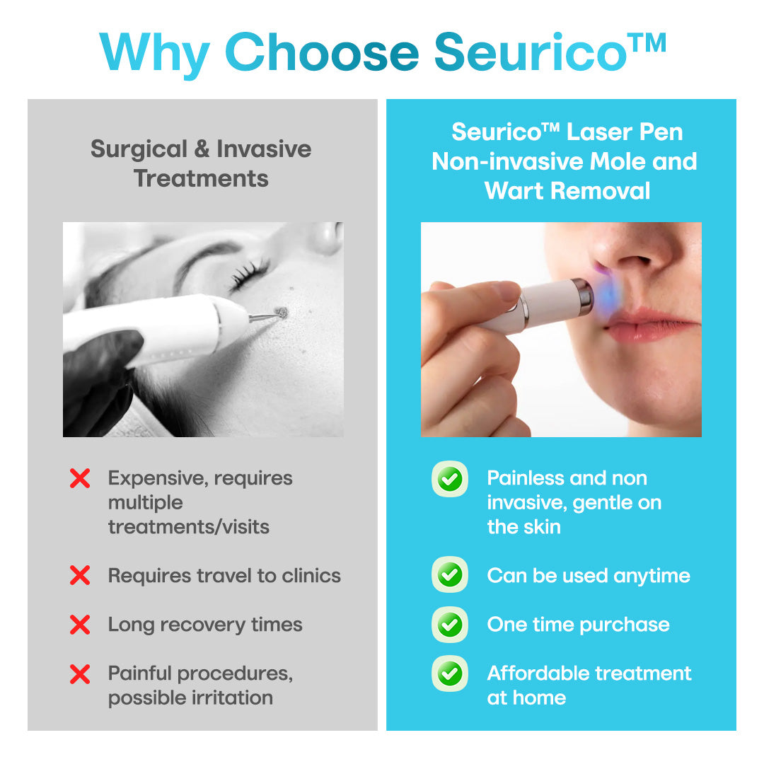 Seurico™ Laser Pen – Non-Invasive Mole and Wart Removal 1–3 days Dermatologist‑Recommended