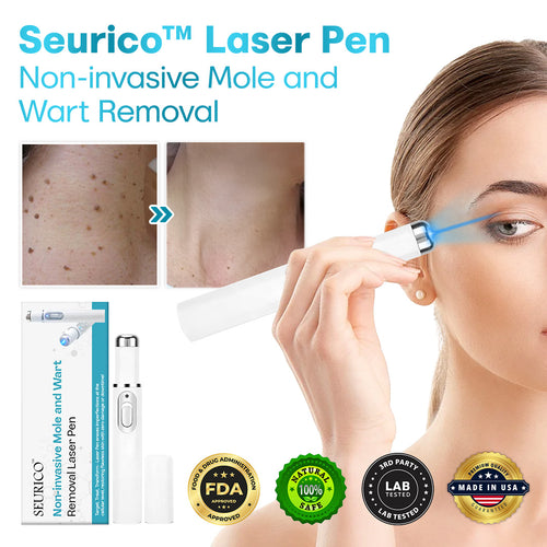 Seurico™ Laser Pen – Non-Invasive Mole and Wart Removal 1–3 days Dermatologist‑Recommended