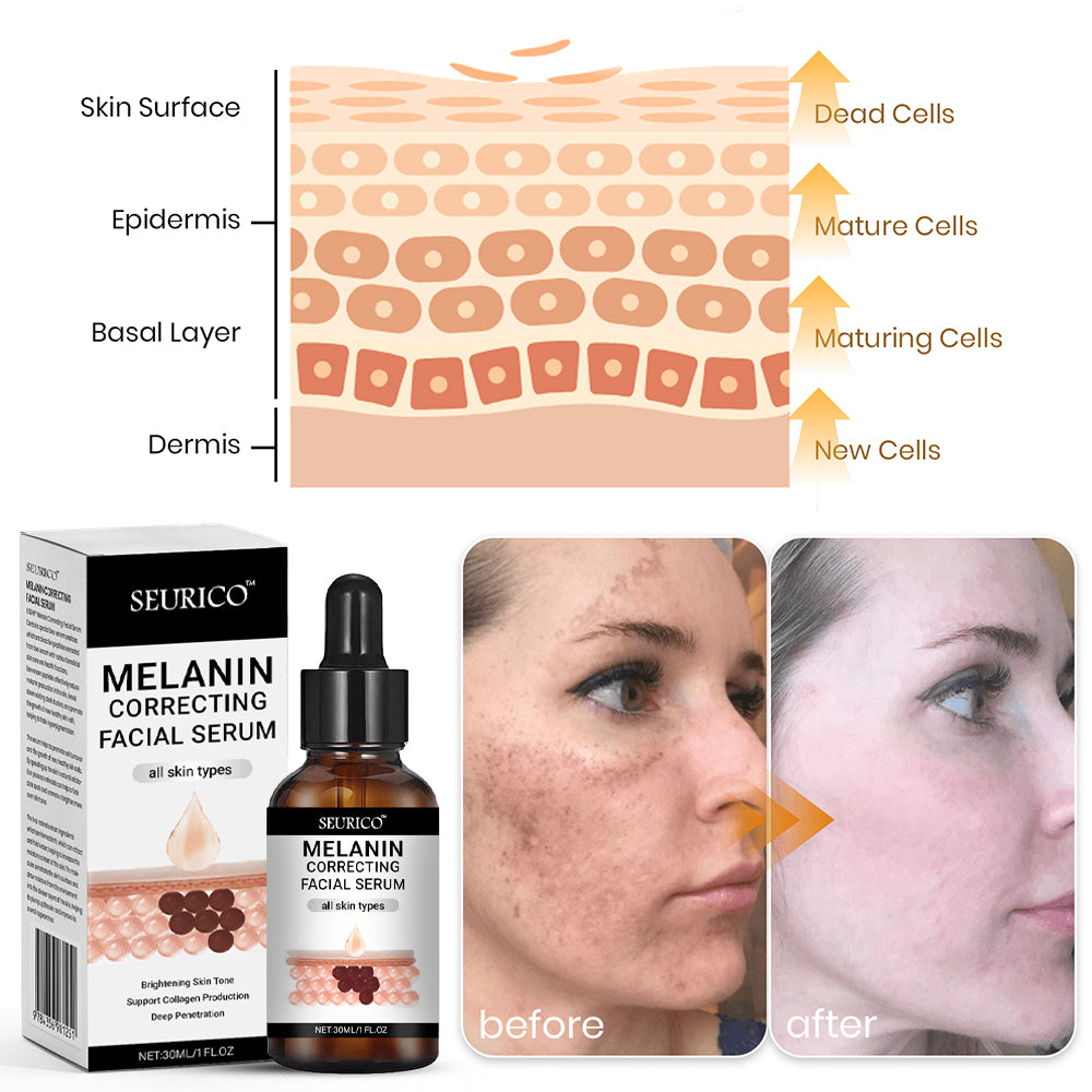 🔥 Hurry! Limited Time Offer!🔥 Fast Dark Spot Remover-Seurico™ Melanin Correcting Facial Serum