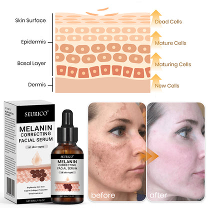 🔥 Hurry! Limited Time Offer!🔥 Fast Dark Spot Remover-Seurico™ Melanin Correcting Facial Serum