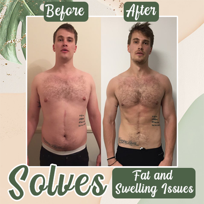 【Last Minute! 80% OFF】Seurico™ 𝗚𝗟𝗣 - 1 Microneedle Slimming Belt – Pure Natural Herbal Extract 🌿✨