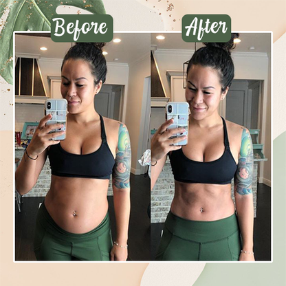【Last Minute! 80% OFF】Seurico™ 𝗚𝗟𝗣 - 1 Microneedle Slimming Belt – Pure Natural Herbal Extract 🌿✨