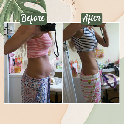 【Last Minute! 80% OFF】Seurico™ 𝗚𝗟𝗣 - 1 Microneedle Slimming Belt – Pure Natural Herbal Extract 🌿✨