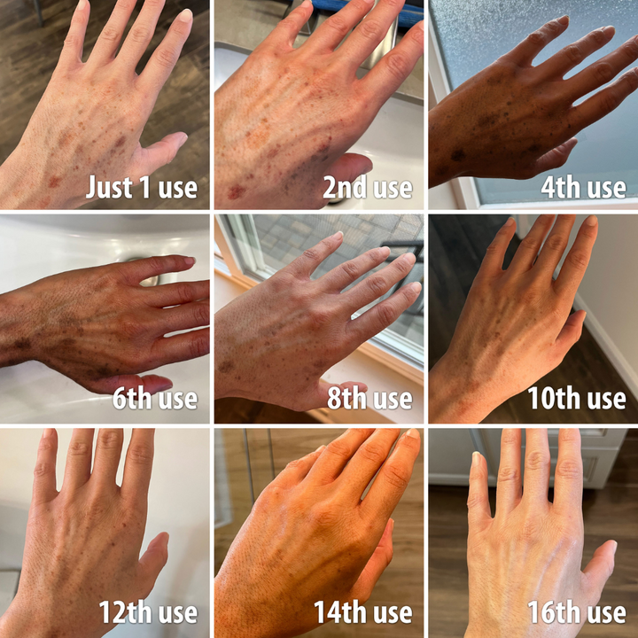 🔥 Hurry! Limited Time Offer!🔥 Fast Dark Spot Remover-Seurico™ Melanin Correcting Facial Serum