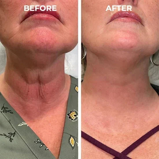 🎁 Last Day Promotion! Seurico™ Clostridium botulinum Face Serum - Smooth & Rejuvenate Your Skin Today ✨💆‍♀️ (Copy)