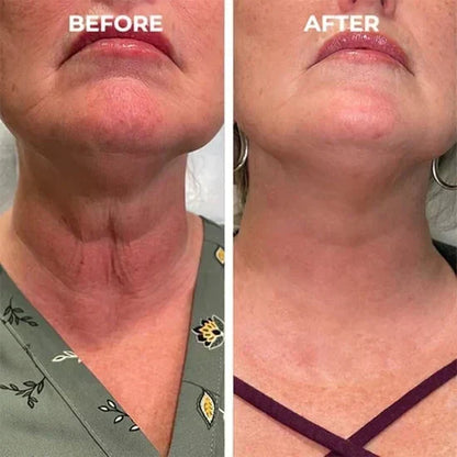 🎁 Last Day Promotion! Seurico™ Clostridium botulinum Face Serum - Smooth & Rejuvenate Your Skin Today ✨💆‍♀️ (Copy)