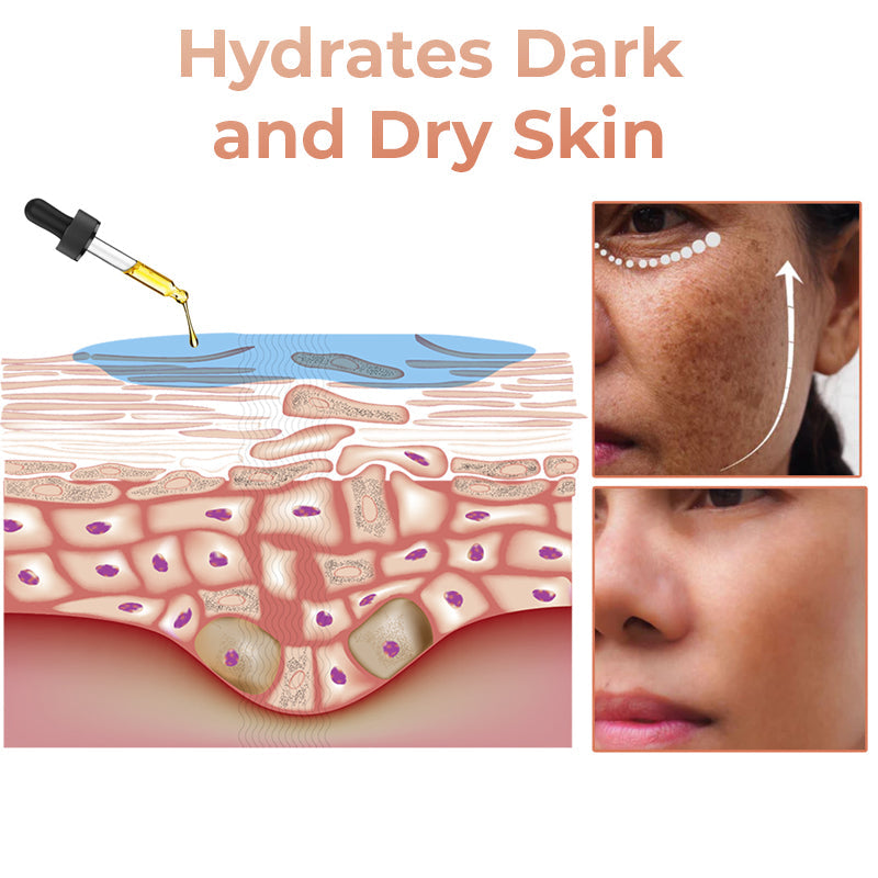 🔥 Hurry! Limited Time Offer!🔥 Fast Dark Spot Remover-Seurico™ Melanin Correcting Facial Serum