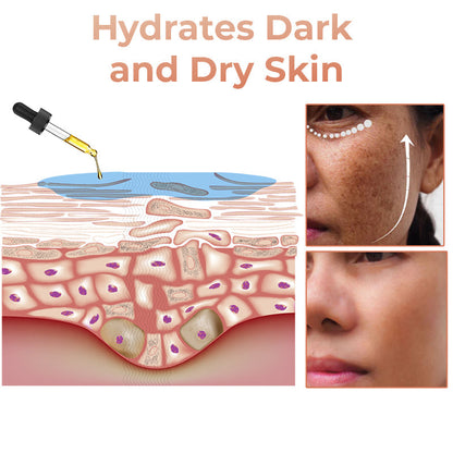 🔥 Hurry! Limited Time Offer!🔥 Fast Dark Spot Remover-Seurico™ Melanin Correcting Facial Serum