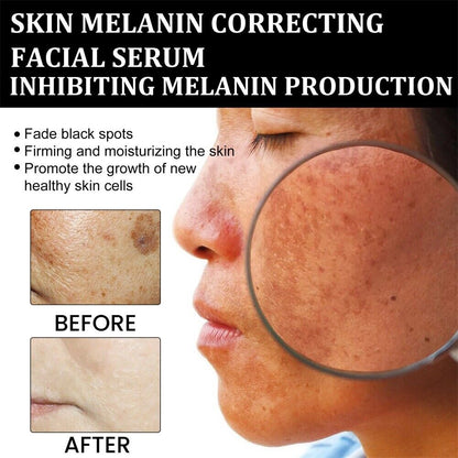 🔥 Hurry! Limited Time Offer!🔥 Fast Dark Spot Remover-Seurico™ Melanin Correcting Facial Serum